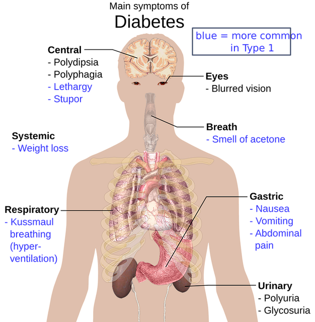 diabetes symptoms 